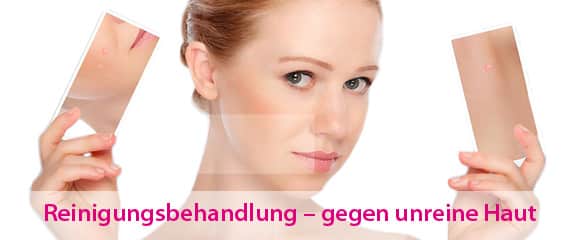 Akne Behandlung Kosmetik Wiesbaden